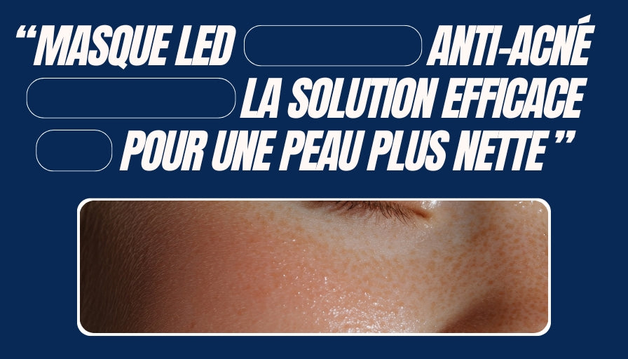 Masque LED anti-acné : la solution efficace pour une peau plus nette